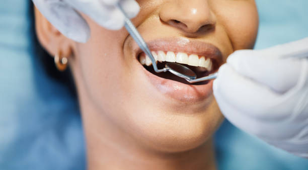Best Chipped Tooth Repair Near Me  in Douglas, MI